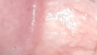 Incredible Cock, Unique of Slippery Phimosis by the Robust Body.