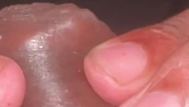 Forskin Play & My Thick Veiny Cock Shooting a Massive Creamy Load