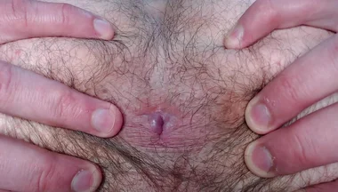 By Popular Demand, I Farted and Showed My Hairy Ass.