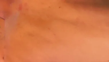 Asian Got Fucked by Huge White Cut Cock