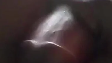 Sperm