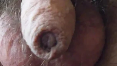 My Penis Walkabout