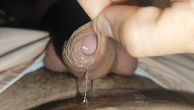 Removal of Phimosis to the White Juice of Hot Cum.