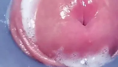 Penis Machine with a New Attachment