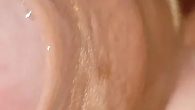 Large Cheese Accumulated in Close up of Glans