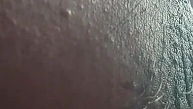 Armpit