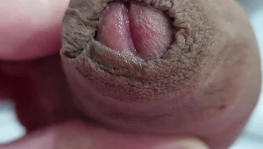 The Head of My Penis