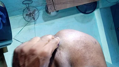 Anal sex