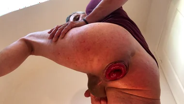 Gaping Prolapse Powerful Ejaculation