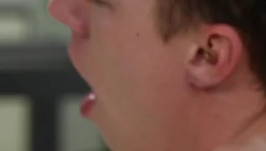 Exposed