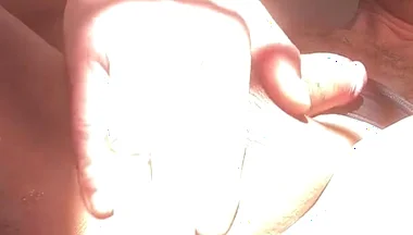Great Idea to Take Care of Your Anal Prolapse