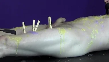 Pinching pegs leave welts