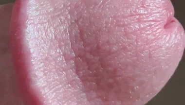 Closeup of Penis with One Vein