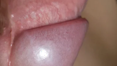 Amazing Upright Rough Venous Frenulum