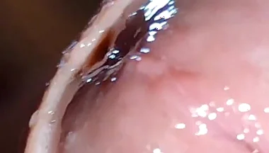 Glans Eye Watering After Intense Fucking.