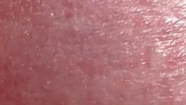 Sperm Close-up Front