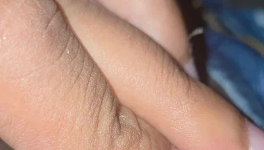 Closeup