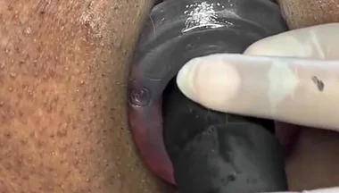 Ass Gape