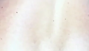 Extreme Anus Gape