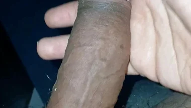 Trying to Poison My Penis with a Ring