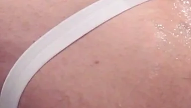 Fisting