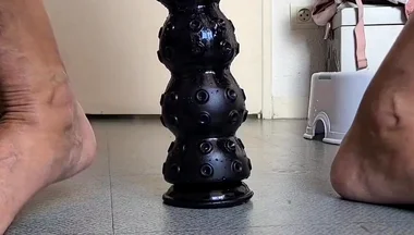Dilatation Anal Xxl