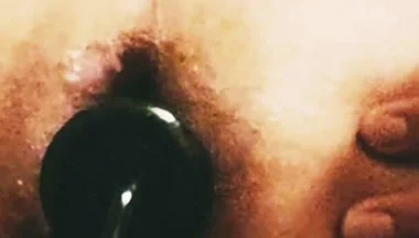 Anal Play