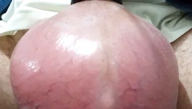 Infusion Sack