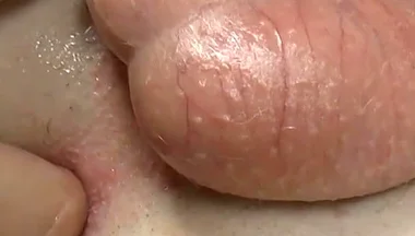 Stick Your Fingers in Casper's Butt