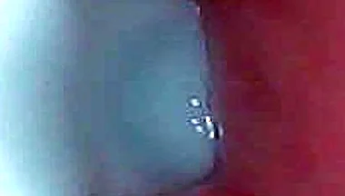 I Couldn’t Believe What Happens Inside the Penis as Sperm Passes Through (endoscopic Footage)