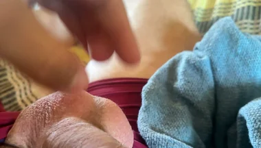 Extreme Venous Phimosis in the Pump!