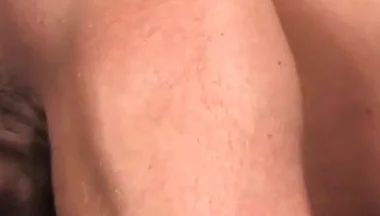 Rugburn