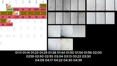 Ruined Orgasm 3 Times, Drain Cum for 15 Days.251027-251110