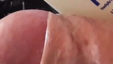 Extreme Detachment of Phimosis with Natural Oil,.