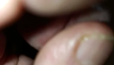 Is My Meatus Open?