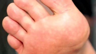 Golden Foot Bath for Pigs