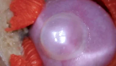 The Camera Inside the Deep Pussy Records a Huge Ejaculation with a Stuck Condom 4K