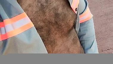 My Hairy Body