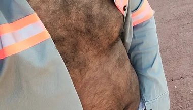 My Hairy Body