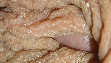 The World's Largest Foreskin Opening and Closing.