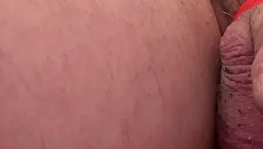 Mind Blowing Prostate Explision